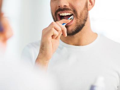 Illustration of an overbite