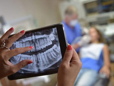 Dentist looking at digital x-rays to plan tooth extractions