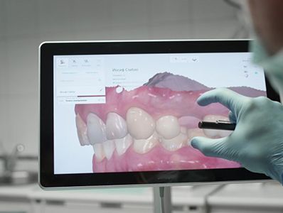 Dentist examining a virtual model of a patient’s teeth