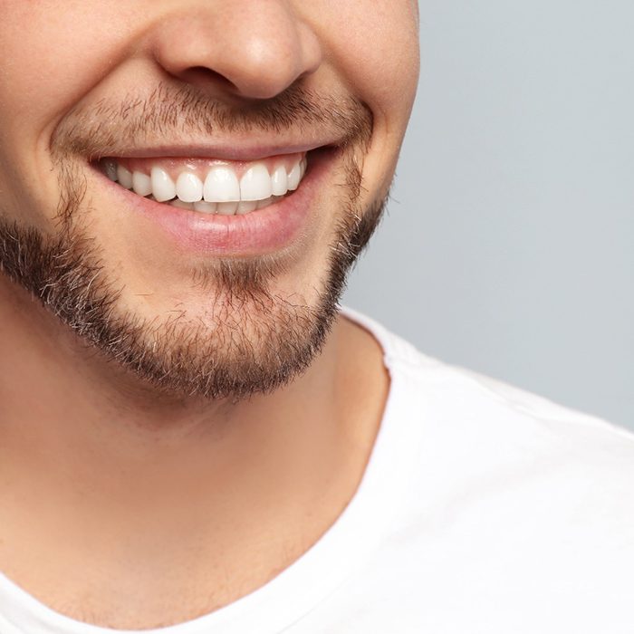 man closeup smile makeover in Annandale 