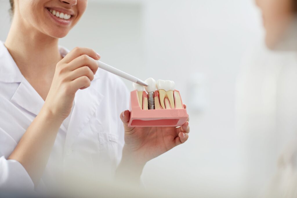 Nose-down view of dentist pointing to sample implant with white pen