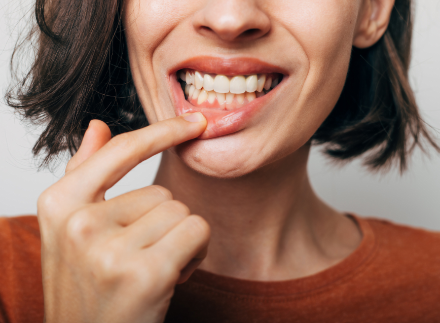 Woman pulling lip down to show gums